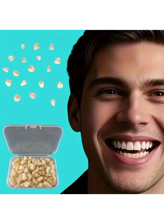 100 Pieces Temporary Veneers Set Front And Rear Teeth For Instant Smile Makeover - Image 1